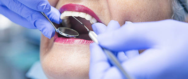 Best Emergency Dentist for Lost Fillings or Crowns in Shrewsbury, PA